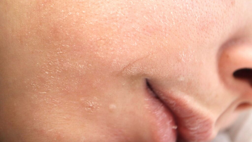 What Is a Damaged Skin Barrier – and How Do You Fix It